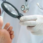 Чем лечить зуд между пальцами ног