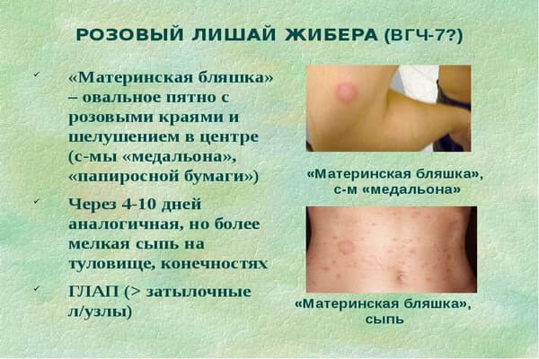 Мазь от лишая на коже у человека: противолишайные препараты для людей