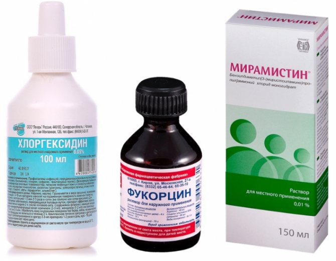 Рецидив папилломы после удаления: почему появляются новые?